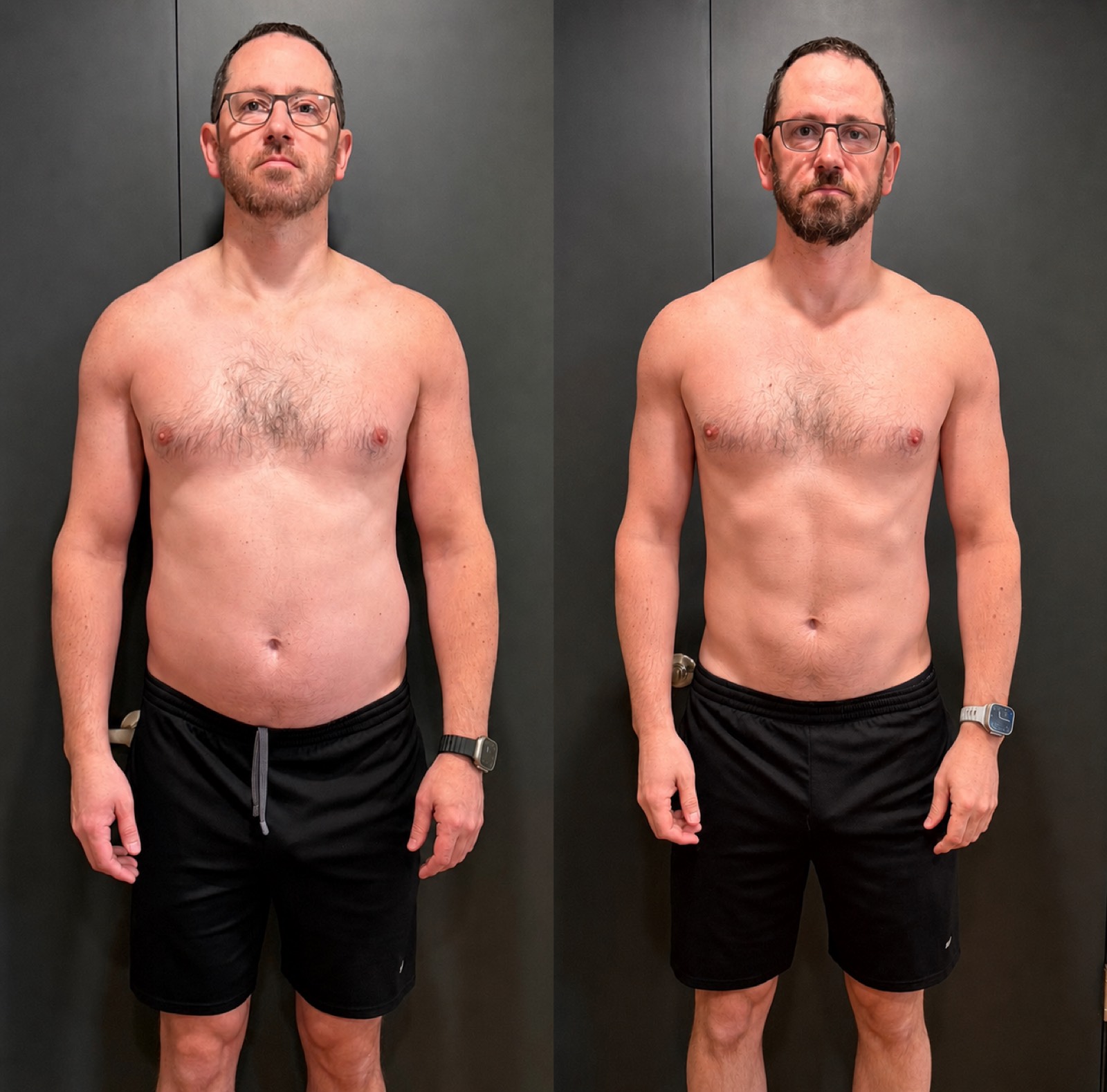 Client body transformation, before and after